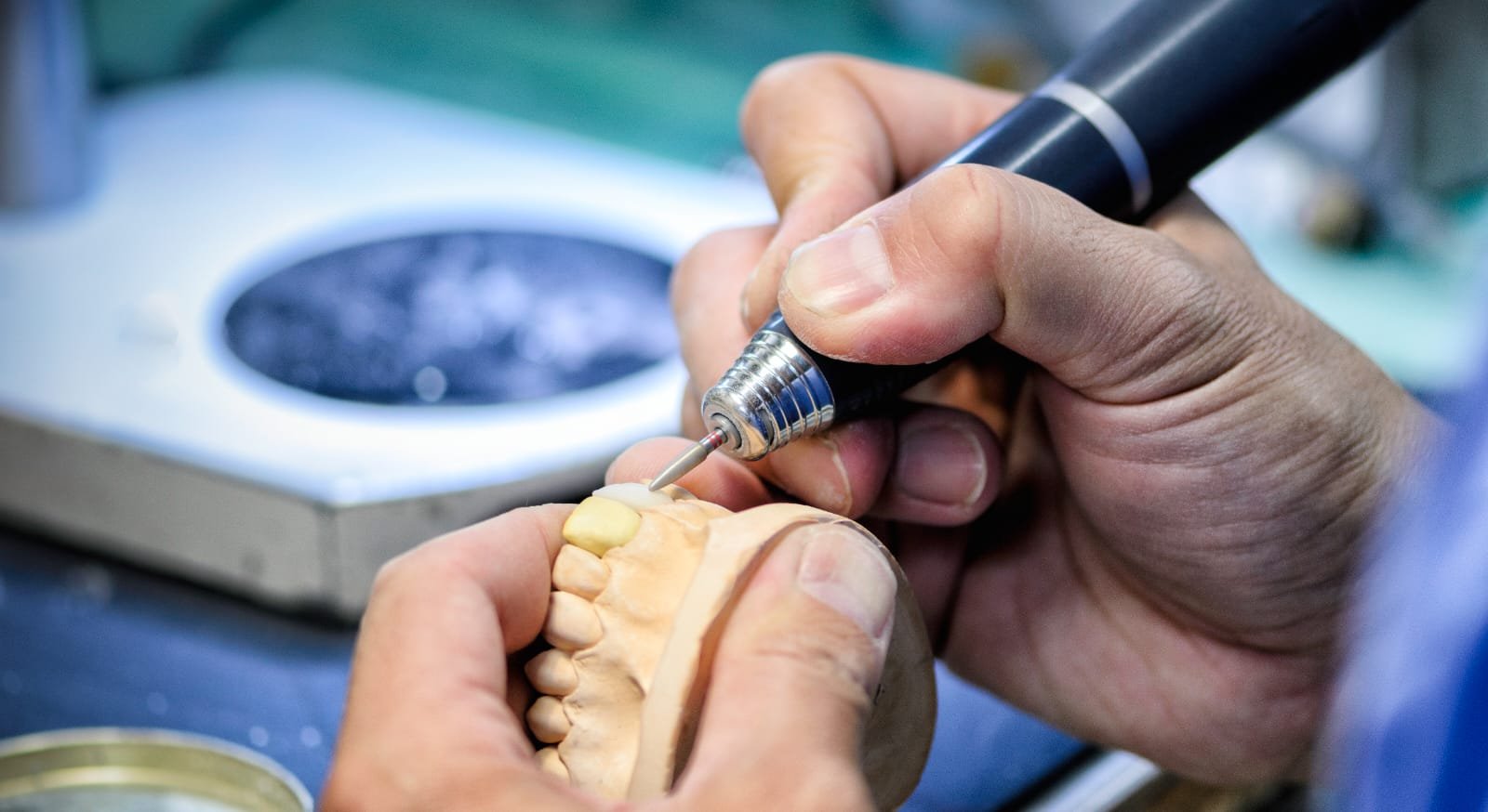Sorriso com prótese protocolo sobre implantes